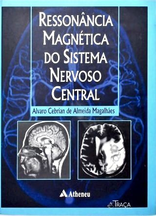 Ressonância Magnética do Sistema Nervoso Central